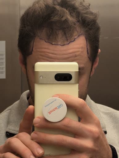 Review image